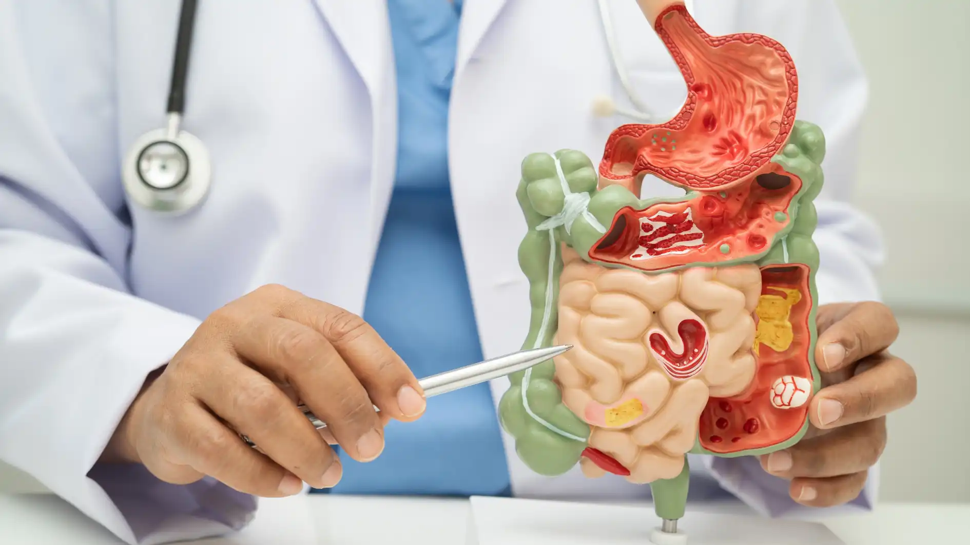 Ilustrasi Sakit Perut Bagian Bawah